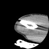 SPORK, NICO - 22.03.1976 - 02.08.2022 - CT obere Extremität - 17:51:17